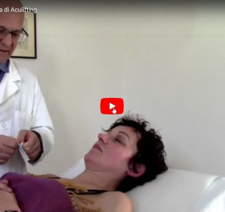 Aculifting: dimostrazione pratica